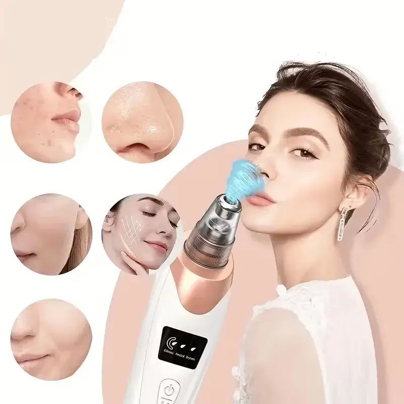 USB Rechargeable Blackhead Remover with 4 Modes