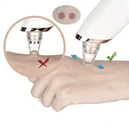 USB Rechargeable Blackhead Remover with 4 Modes